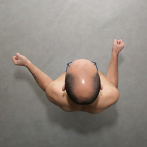 Immagine di persona con movimento limitato dalla capsulite adesiva